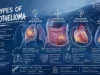 4 Types of Mesothelioma: Pleural, Peritoneal, Pericardial, and Testicular