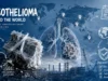 Mesothelioma Around the World: Risk Factors, Asbestos Exposure, and Global Burden